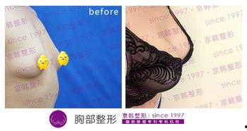 布袋胸图片,时尚潮流中的独特魅力解析